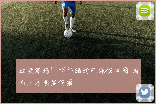 血染赛场！ESPN晒姆巴佩伤口图 眉毛上方明显伤痕